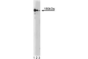Western blot analysis of NMDAR2B on a rat cerebrum lysate. (GRIN2B 抗体  (AA 892-1051))