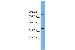 WB Suggested Anti-DDHD2 Antibody Titration: 0. (DDHD2 抗体  (N-Term))