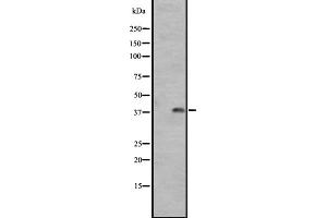 Western blot analysis of GPR1 expression in A431 whole cell lysate ,The lane on the left is treated with the antigen-specific peptide. (G Protein-Coupled Receptor 1 抗体  (C-Term))