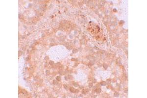 Immunohistochemical staining of human testis cells with WDR92 polyclonal antibody  at 10 ug/mL. (WDR92 抗体  (Internal Region))