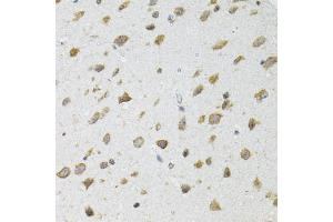 Immunohistochemistry of paraffin-embedded mouse brain using SIRT3 antibody (ABIN5973348) at dilution of 1/100 (40x lens). (SIRT3 抗体)
