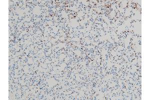 Immunohistochemistry (IHC) image for anti-Cofilin 1 (CFL1) (pSer3) antibody (ABIN6255180)