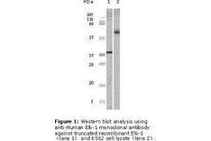 Image no. 1 for anti-ELK1, Member of ETS Oncogene Family (ELK1) antibody (ABIN207629) (ELK1 抗体)