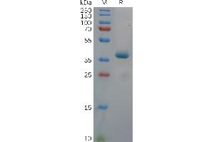 Human (312-391) Protein, hFc Tag on SDS-PAGE under reducing condition.
