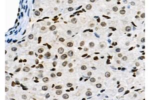 ABIN6263641 and ABIN6278983 at 1/100 staining Rat ovarian tissue by IHC-P. (NKAP 抗体  (N-Term))