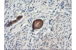 Image no. 2 for anti-Proteasome Subunit alpha 4 (PSMA4) antibody (ABIN1500457) (PSMA4 抗体)