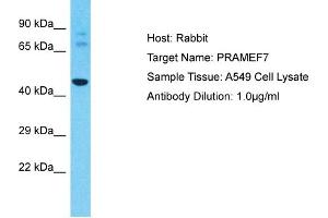 Host: Rabbit Target Name: PRAMEF7 Sample Type: A549 Whole Cell lysates Antibody Dilution: 1. (PRAMEF7 抗体  (N-Term))