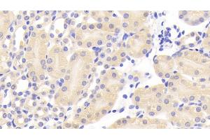 Detection of CEACAM1 in Mouse Kidney Tissue using Polyclonal Antibody to Carcinoembryonic Antigen Related Cell Adhesion Molecule 1 (CEACAM1) (CEACAM1 抗体  (AA 35-143))