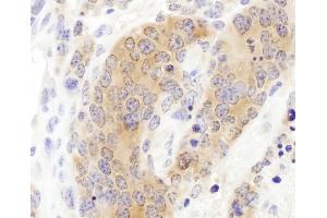 Immunohistochemistry (IHC) image for anti-Chaperonin Containing TCP1, Subunit 3 (Gamma) (CCT3) (AA 300-350) antibody (ABIN7453614)