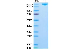 SDS-PAGE (SDS) image for SARS-CoV-2 Spike (B.1.1.529 - Omicron), (Trimer) protein (His tag) (ABIN7274386)