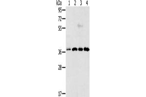 Gel: 12 % SDS-PAGE, Lysate: 40 μg, Lane 1-4: Hela cells, Jurkat cells, 293T cells, 231 cells, Primary antibody: ABIN7193012(VEGFA Antibody) at dilution 1/300, Secondary antibody: Goat anti rabbit IgG at 1/8000 dilution, Exposure time: 50 seconds