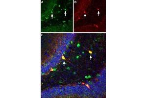 Multiplex staining of ASIC1 and parvalbumin in rat hippocampus - Immunohistochemical staining of immersion-fixed, free floating rat brain frozen sections using Guinea pig Anti-ASIC1 Antibody (ABIN7042914, ABIN7045410 and ABIN7045411), (1:300). (ASIC1 抗体  (C-Term, Intracellular))