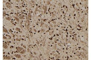 Immunohistochemistry (IHC) image for anti-serpin Peptidase Inhibitor, Clade B (Ovalbumin), Member 3 (SERPINB3) (C-Term) antibody (ABIN6265007)