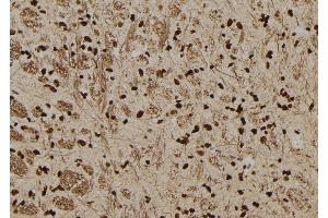 ABIN6277578 at 1/100 staining Rat brain tissue by IHC-P. (SERPINB3 抗体  (C-Term))