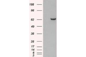 Western Blotting (WB) image for anti-Growth Factor Receptor-Bound Protein 7 (GRB7) (N-Term) antibody (ABIN2465793) (GRB7 抗体  (N-Term))