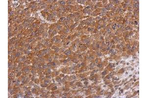 IHC-P Image Immunohistochemical analysis of paraffin-embedded H1299 xenograft, using Dysbindin, antibody at 1:500 dilution. (DTNBP1 抗体)