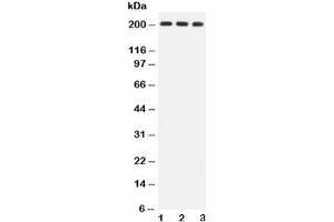 Western blot testing of BRCA1 antibody and Lane 1:  HeLa (BRCA1 抗体  (AA 1661-1863))