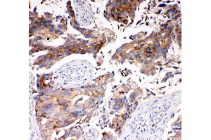 Immunohistochemistry (IHC) image for anti-Solute Carrier Family 16 (Monocarboxylic Acid Transporters), Member 4 (SLC16A4) (AA 134-148), (N-Term) antibody (ABIN3044003)