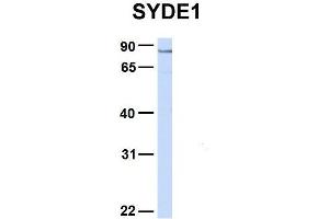 Host:  Rabbit  Target Name:  SYDE1  Sample Type:  Hela  Antibody Dilution:  1.