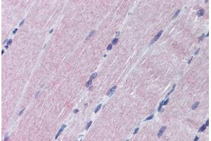 Human Skeletal Muscle (formalin-fixed, paraffin-embedded) stained with MAP2K6 antibody ABIN290187 at 1:50 followed by biotinylated goat anti-rabbit IgG secondary antibody ABIN481713, alkaline phosphatase-streptavidin and chromogen. (MAP2K6 抗体  (N-Term))