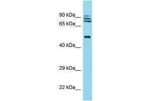 Western Blotting (WB) image for anti-Tripartite Motif Containing 64 (TRIM64) (N-Term) antibody (ABIN2500705) (TRIM64 抗体  (N-Term))