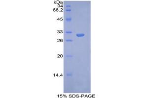 SDS-PAGE analysis of Human Glypican 4 Protein. (GPC4 蛋白)