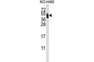 Western Blotting (WB) image for anti-Coxsackie Virus and Adenovirus Receptor (CXADR) antibody (ABIN3001668) (Coxsackie Adenovirus Receptor 抗体)