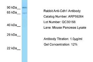 Western Blotting (WB) image for anti-Cadherin 1, Type 1, E-Cadherin (Epithelial) (CDH1) (C-Term) antibody (ABIN970364) (E-cadherin 抗体  (C-Term))