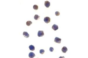 Immunohistochemistry (IHC) image for anti-Checkpoint Kinase 2 (CHEK2) (N-Term) antibody (ABIN1031318) (CHEK2 抗体  (N-Term))