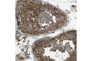 Immunohistochemical staining of human testis with DIAPH2 polyclonal antibody  shows cytoplasmic positivity in cells of seminiferus ducts at 1:500-1:1000 dilution. (DIAPH2 抗体)