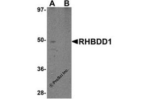 Western Blotting (WB) image for anti-Rhomboid Domain Containing 1 (RHBDD1) (C-Term) antibody (ABIN1030618) (RHBDD1 抗体  (C-Term))
