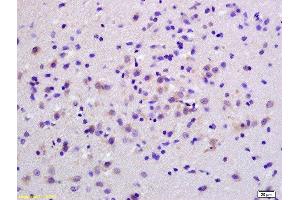Immunohistochemistry (Paraffin-embedded Sections) (IHC (p)) image for anti-S100 Calcium Binding Protein B (S100B) (AA 31-92) antibody (ABIN676703)