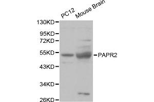 Western blot analysis of various cell lines, using PARK2 antibody. (Parkin 抗体)