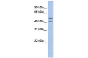 Image no. 1 for anti-Solute Carrier Family 37 (Glucose-6-Phosphate Transporter), Member 4 (SLC37A4) (AA 179-228) antibody (ABIN6743205) (SLC37A4 抗体  (AA 179-228))