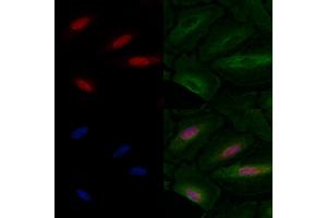 ABIN6257236 and ABIN6275800 staining  cells by IF/ICC.