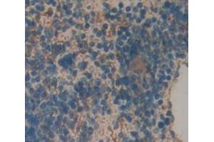 Used in DAB staining on fromalin fixed paraffin- embedded Kidney tissue (VSNL1 抗体  (AA 39-184))