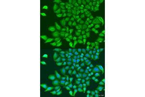 Immunofluorescence analysis of U2OS cells using TUBGCP3 antibody. (TUBGCP3 抗体  (AA 1-250))