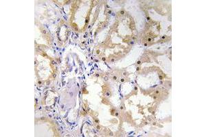 Immunohistochemical analysis of Granzyme H staining in human kidney formalin fixed paraffin embedded tissue section. (GZMH 抗体  (Center))