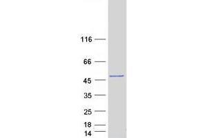 Western Blotting (WB) image for 3-phosphoinositide Dependent Protein Kinase-1 (PDPK1) protein (Myc-DYKDDDDK Tag) (ABIN2728574)