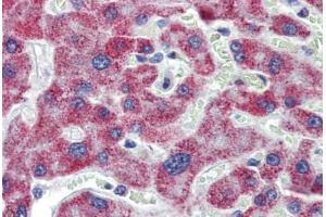 Liver, Human: Formalin-Fixed, Paraffin-Embedded (FFPE) (ACAA1 抗体  (AA 36-85))