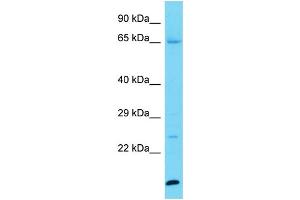Host: Rabbit Target Name: KPRP Sample Type: Jurkat Whole Cell lysates Antibody Dilution: 1. (KPRP 抗体  (C-Term))
