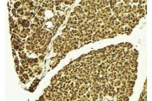 ABIN6276391 at 1/100 staining Mouse pancreas tissue by IHC-P. (SMNDC1 抗体)