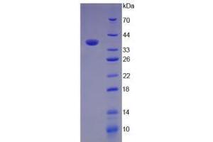 SDS-PAGE analysis of Mouse C3a Protein. (C3a 蛋白)