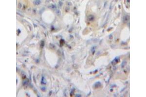 Used in DAB staining on fromalin fixed paraffin-embedded pancreas tissue (REG3A 抗体  (AA 25-142))