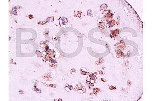 Formalin-fixed and paraffin embedded human placenta tissue labeled with Anti-CD105 Polyclonal Antibody, Unconjugated at 1:200, followed by conjugation to the secondary antibody and DAB staining (Endoglin 抗体  (AA 601-658))