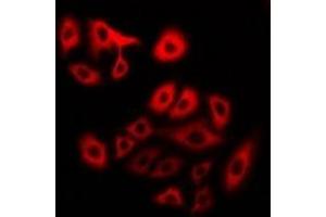 Immunofluorescent analysis of Myosin 1 staining in U2OS cells. (MYH1 抗体)