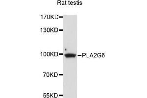 Western blot analysis of extracts of rat testis, using PLA2G6 antibody (ABIN5996267) at 1/1000 dilution. (PLA2G6 抗体)