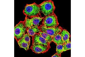 Immunofluorescence analysis of Hela cells using ACTH mouse mAb (green). (ACTH 抗体)