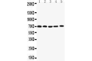 Anti-Kv1.