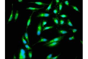 Immunofluorescence staining of Hela cells with ABIN7169132 at 1:266, counter-stained with DAPI. (PAK4 抗体  (AA 1-426))